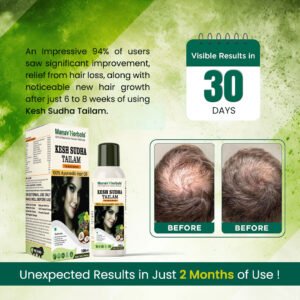 Kesh Sudha Tailam Kit, incuding 100ml Pure Ayrvedic Hair Oil With 30 Ayurvedic Capsules For Strong & Healthy Hair For Men & Women