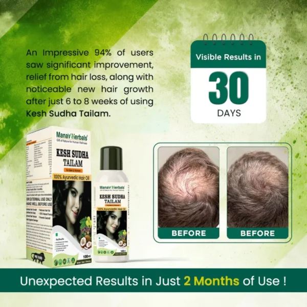 Two Months Pack Kesh Sudha Tailam Kit, incuding 100ml Pure Ayrvedic Hair Oil With 30 Ayurvedic Capsules For Strong & Healthy Hair For Men & Women - Image 2